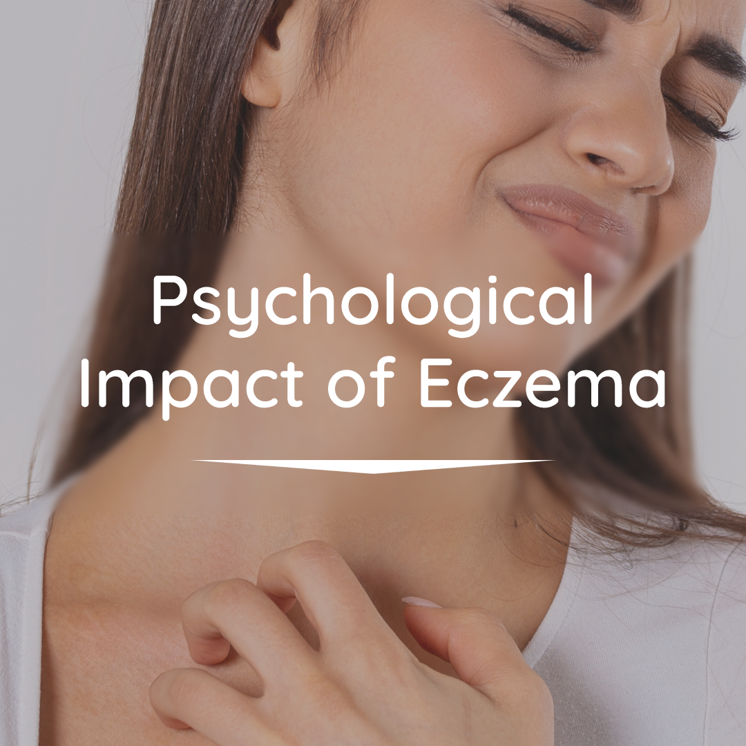 The Psychological Impact Of Eczema