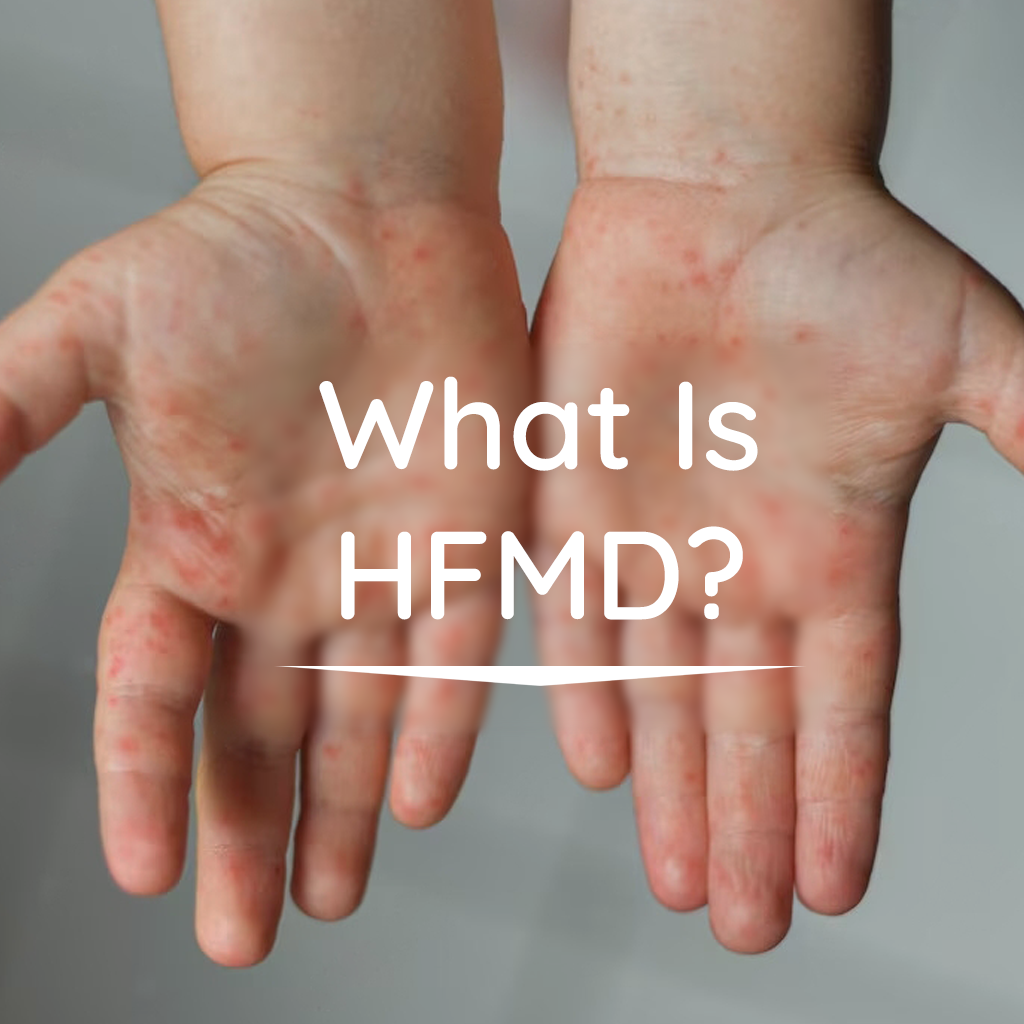What Is Hand, Foot and Mouth Disease?