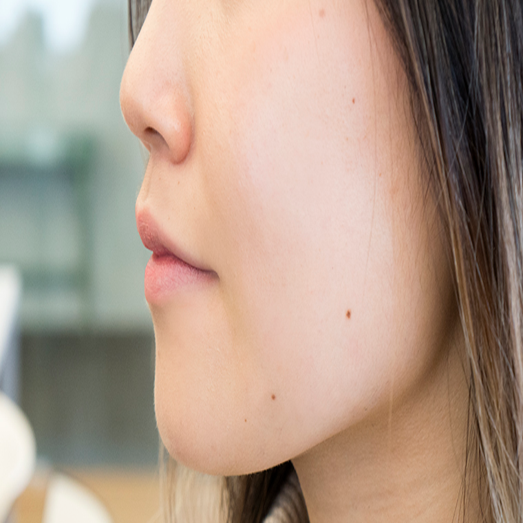How to get smoother skin (Part 6)